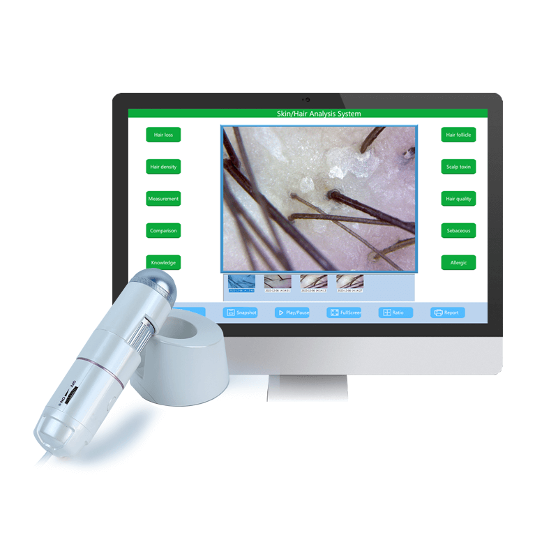 scalp analyzer