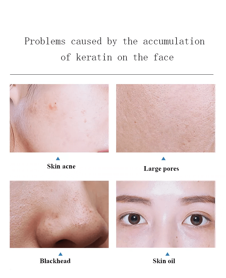 pores cleaning machine