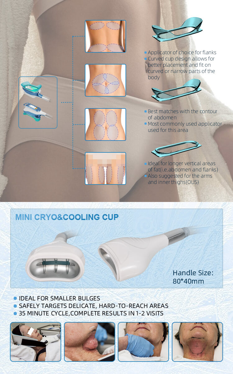 Cryolipolysis fat freezing