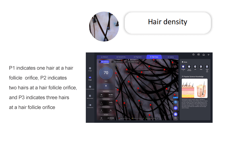 hair analysis machine