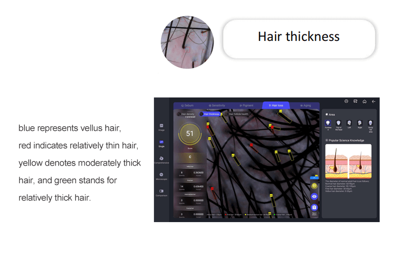 Hair analyzer AI