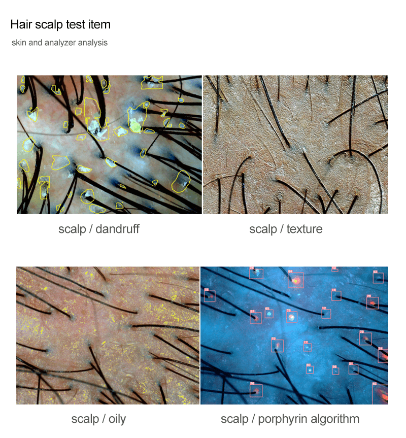 AI skin and hair analysis