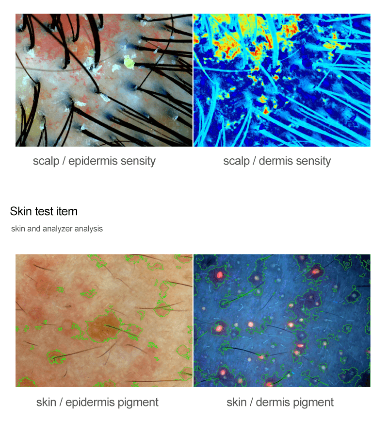 skin and hair analyzer