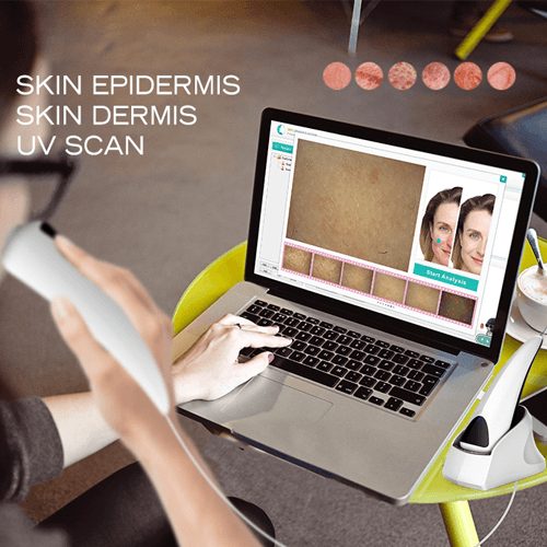 skin and hair analyzer