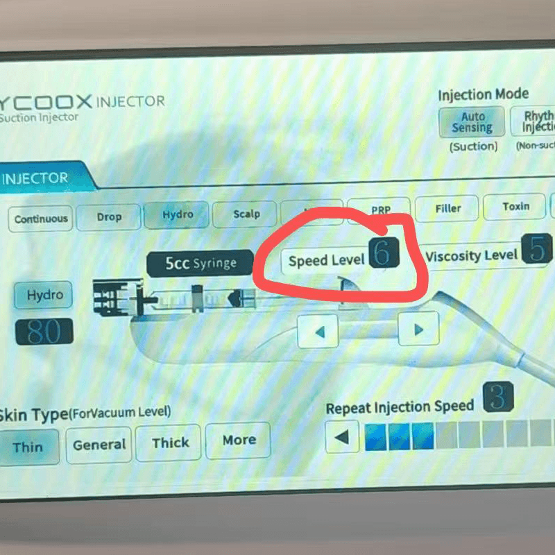 Hycoox injector voice abnormal